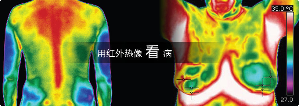 红外热像仪在医疗行业中的应用