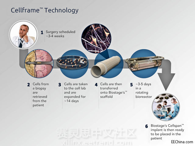神奇，用ZYNQ控制人体器官培植环境