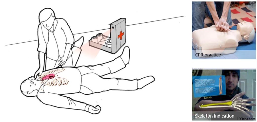 诠鼎推出基于MicroVision的微激光扫描投影技术在医疗领域的应用方案