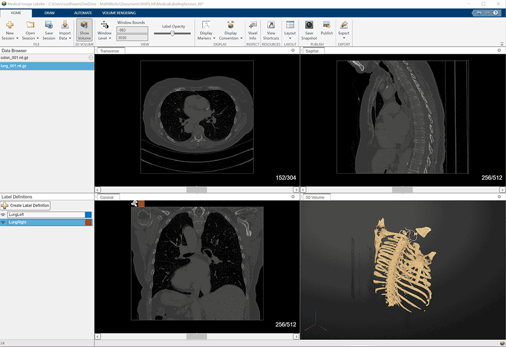 Medical Imaging Toolbox供医学成像AI开发使用.gif