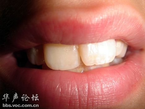 2011013045.jpg